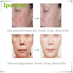 Hete verkoop LED Photon therapie schoonheid apparatuur voor huidverzorging