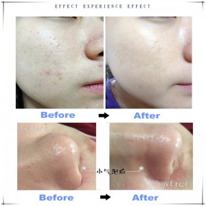 Ipartner Waterstof zuurstof kleine bellen hydrofacial 6 in 1 multifunctionele huidreiniger