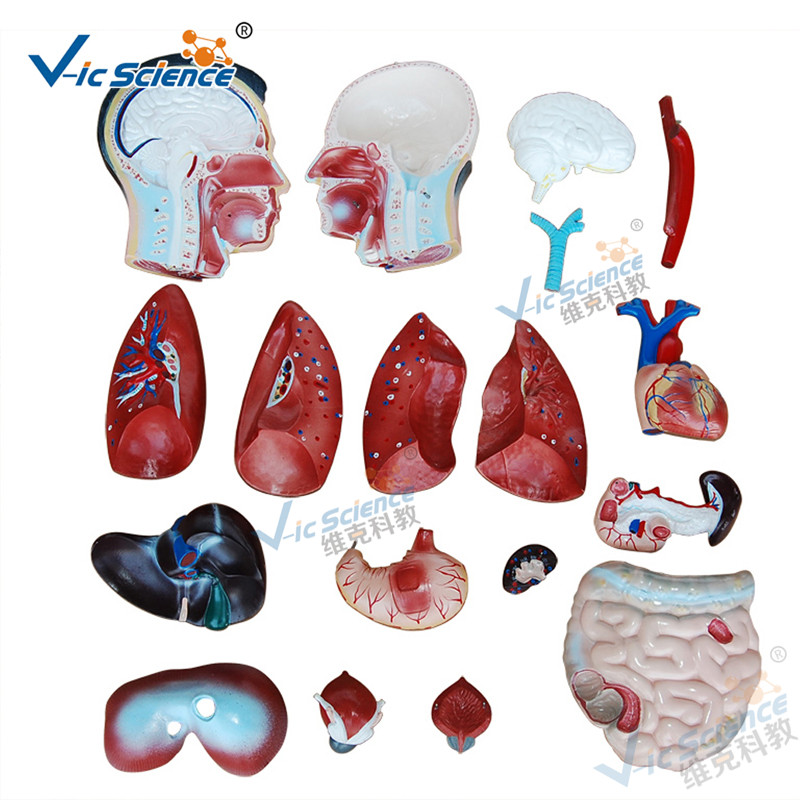 Medische anatomie Menselijk lichaam Model 85cm Mannelijk Torso Model 19 delen