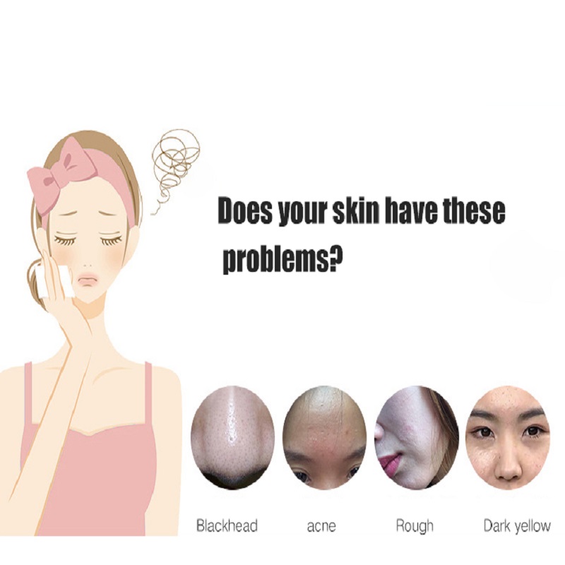 Diepe reinigende exfoliatoren Huidverjonging Face Lift Facial Ultrasone Huid Scrubber
