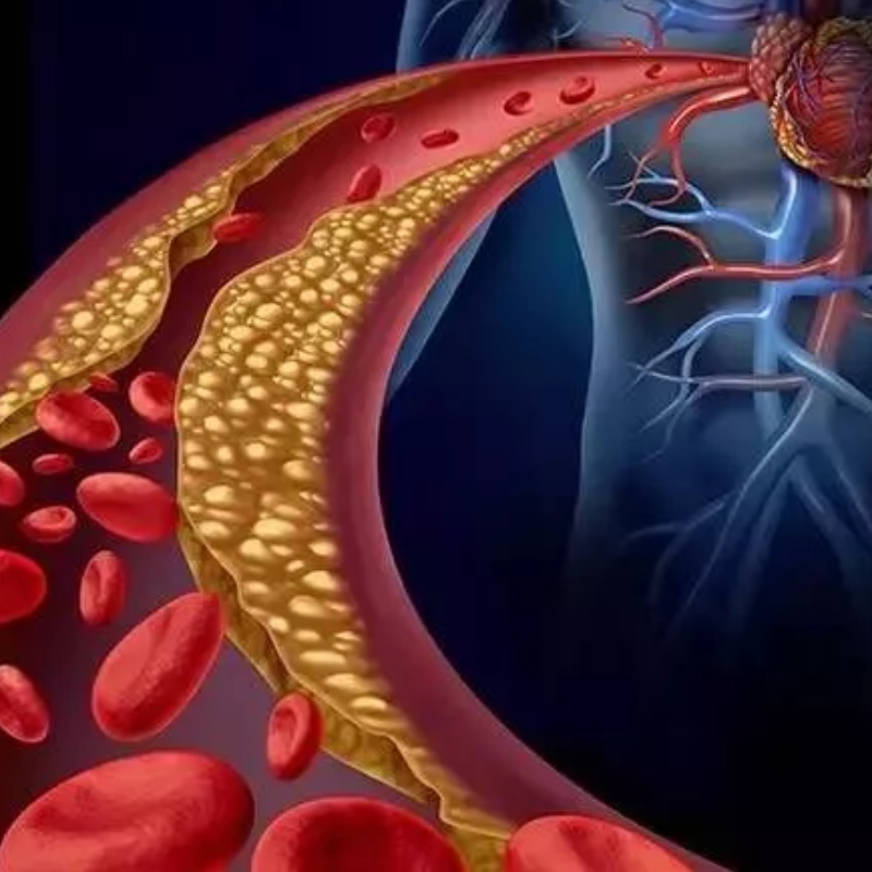 Universiteit van Japan: NMN heeft het potentieel om arteriële stijfheid te verlichten