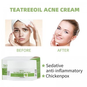 Tea tree olie acne crème