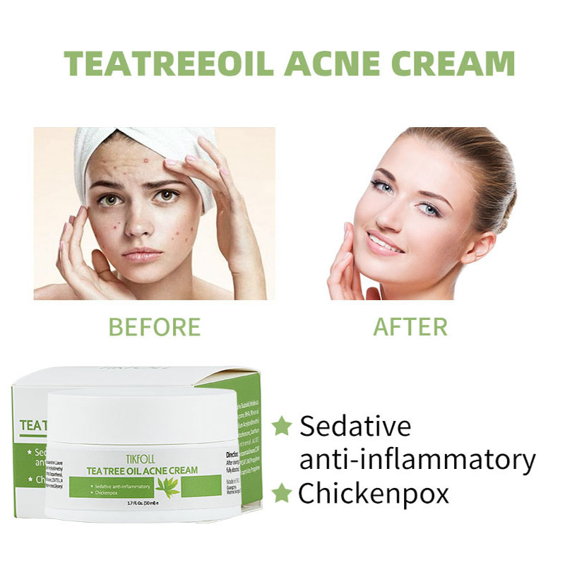 Tea tree olie acne crème