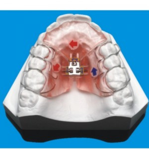 Orthodontische serie